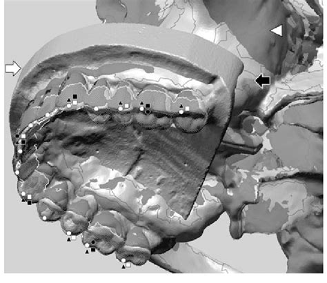 Stereolithography (STL) Files .